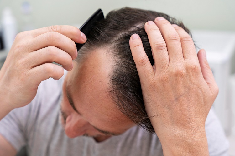Hair Transplant Bangkok-Your Complete Guide Hair Transplant Bangkok-Your Complete Guide